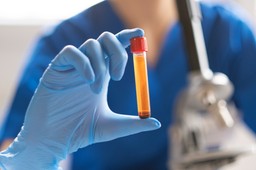 Diagności przeciwni obciążaniu lekarzy kosztami badań