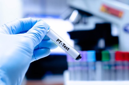 Mit jelent a protombin idő (PT) érték a laborleleten?