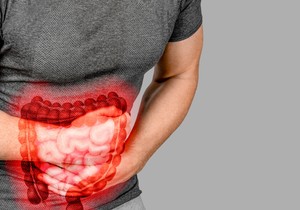 Rak rektuma u porastu među milenijalcima