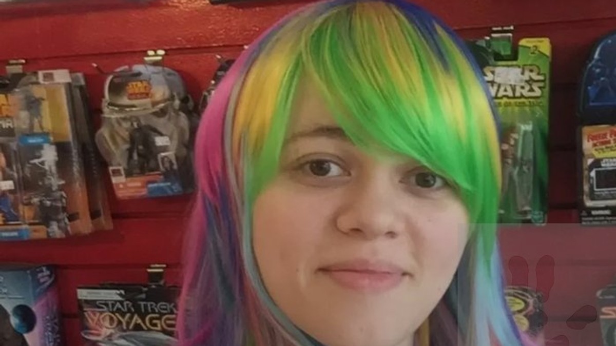 "Lekari su govorili da imam alergiju, kad sam dobila dijagnozu Grejvsove bolesti zaledila sam se od šoka"