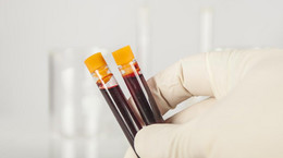 Przechowywanie krwi pępowinowej to głównie biznes?