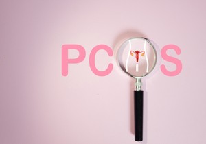 Sindrom policističnih jajnika (PSCO)  je sada poliendokrini metabolički sindrom jajnika (PMOS)