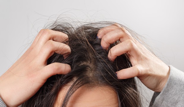 Kraste na temenu mogu biti posledica niza dermatoloških stanja