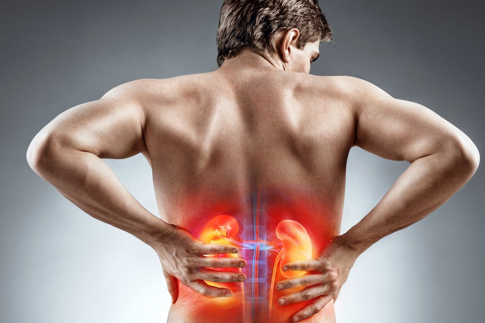 Nierensteine können heftige Koliken verursachen. Beim Verdacht auf die Erkrankung oder bei akuten Schmerzen sollte man einen Arzt aufsuchen.