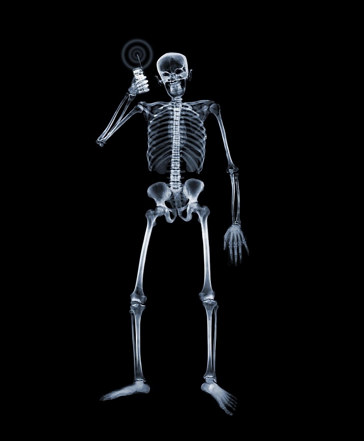 NICK VEASEY x-ray