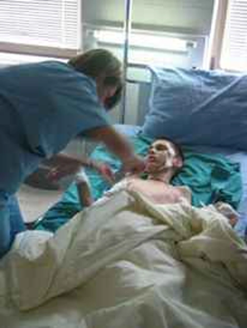 Mitar Čomić posle operacije