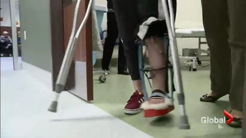 Oporavak traje duže nego sama procedura