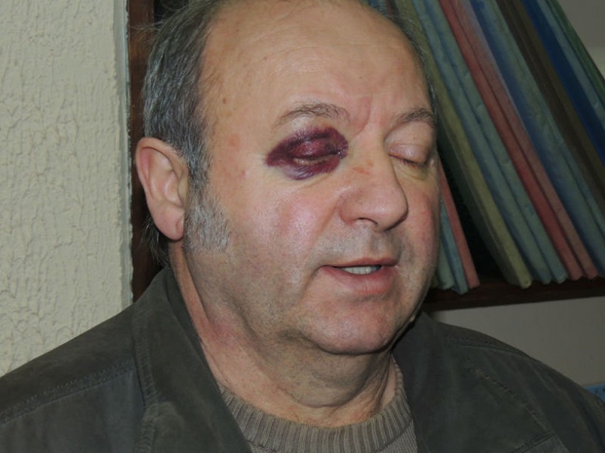 Uspeo sam da se dignem i uzvraćam udarce: Stevan Cvijetković