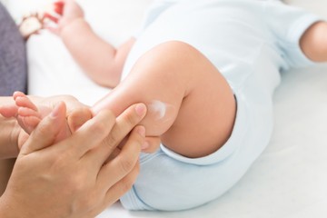 gettyimages-baby-eczema