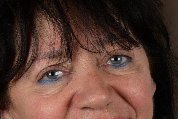 Najpoznatiji stomatolog u Srbiji dr Kozomara NA SVOJOJ MAJCI izveo tehniku za ljude koji nemaju NIJEDAN ZUB: "Video sam OSMEH koji znam ceo život"