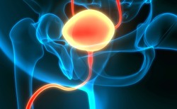 Jak przebiega leczenie raka pęcherza moczowego? Ekspert tłumaczy