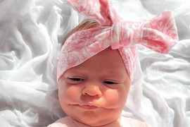 Rođena je sa ŠIROKIM USNAMA, a majke je BILA ŠOKIRANA kada ju je ugledala: Lekari su trčali da je vide, a zaprepastićete se kako danas izgleda