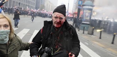 Marsz Niepodległości. Policja zajmie się sprawą postrzelonego fotoreportera