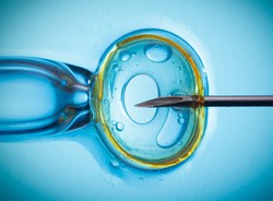 Dzieci z in vitro naznaczone urzędniczą bruzdą