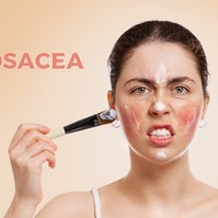 Rosacea: okai, tünetei és kezelése