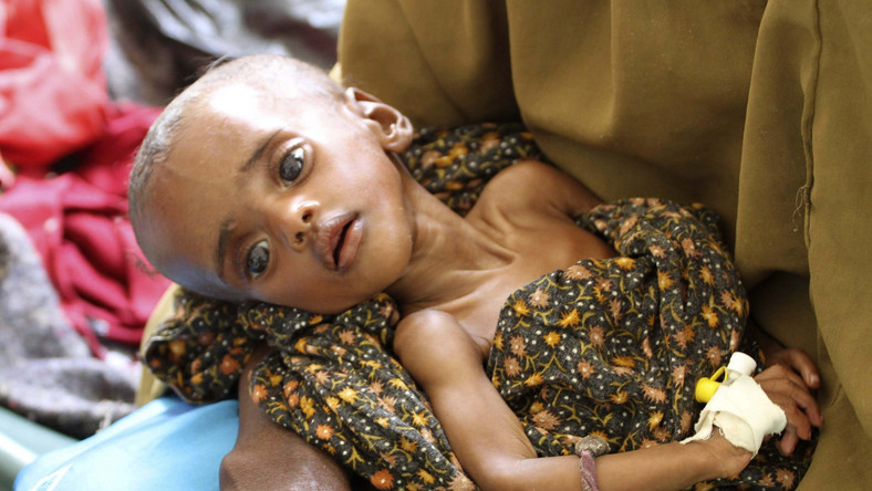 Anfa ma trzy miesiące i waży 2,5 kg. Grozi jej śmierć głodowa. W podobnej sytuacji są setki tysięcy mieszkańców Somalii. ONZ ostrzega, że jeśli pomoc dla tego regionu nie zostanie zwiększona, w ciągu najbliższych czterech miesięcy z głodu umrze tu około 750 tysięcy osób.