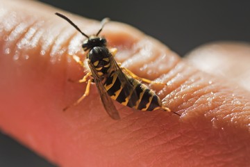 Darázscsípés, méhcsípés után ezek a krémek segíthetnek enyhíteni a tüneteket
