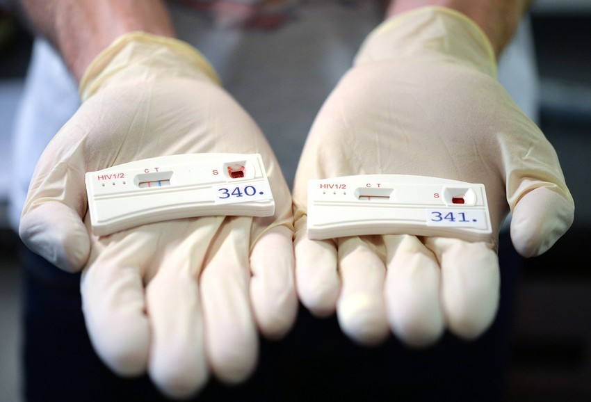 Pozitivan i negativan test na virus HIV-a (foto: ilustracija)
