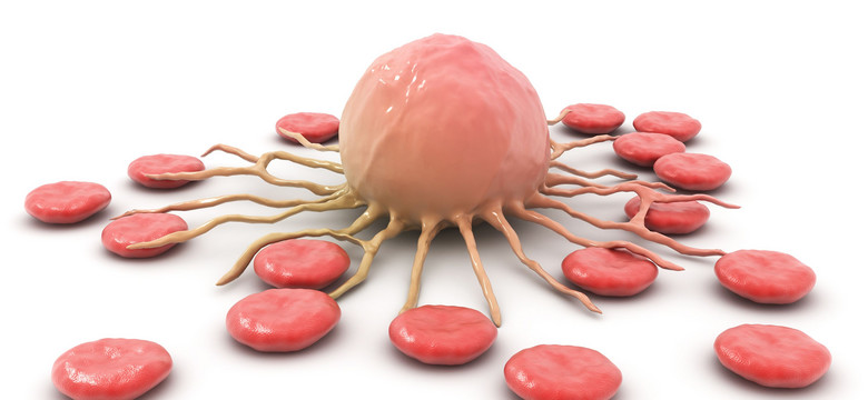 Zespoły mielodysplastyczne - mało znany nowotwór krwi. Częstszy niż białaczka