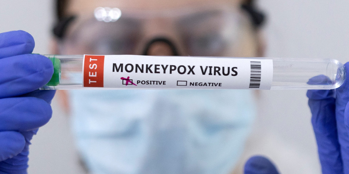 Hiszpania. Drugi przypadek śmierci z powodu zarażenia wirusem małpiej ospy. 