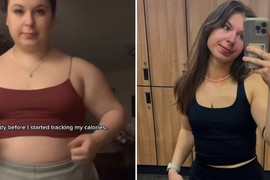 Medicinska sestra (21) se PREPOLOVILA za samo godinu dana: "Ovaj doručak je tajna mog uspeha"