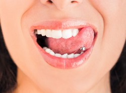 Niebezpieczna moda. Ten kolczyk może zrobić dziurę w brzuchu