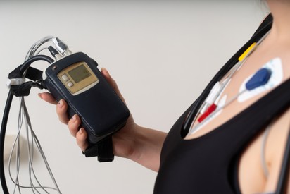 Mi a Holter-monitorozás és mit mutat ki?