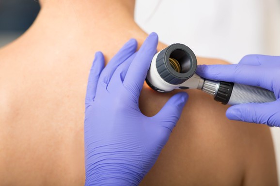 Dermatovenerolozi stižu u Prijepolje i Novu Varoš: Besplatni pregledi kože za sve građane