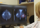 Mammográfia: nem fáj, 3 perc a vizsgálat és azonnal van lelet