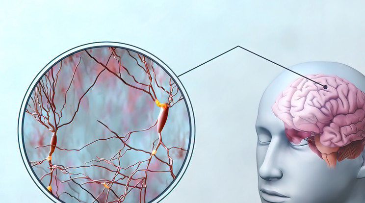 A kutatók képesek voltak funkcionáló agyszövetet létrehozni 3D-nyomtatás segítségével /Illusztráció: Northfoto