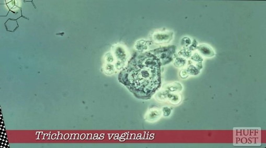 Parazit koji izaziva najviše sekusalno prenosivih bolesti u Americi   Protozoa koja izazvia najviše infekcija širom sveta   Protozoa koja izaziva dijareju   Parazit koji se prenosi iz kutija s peskom za mačke   I ove protozoe mogu da dovedu do smrtnog ishoda