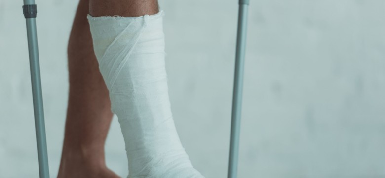 Aż pół tony gipsu użyto podczas ferii zimowych w zakopiańskim szpitalu