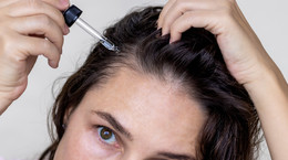 Jakie wcierki na wypadanie włosów są skuteczne? To poleca farmaceutka