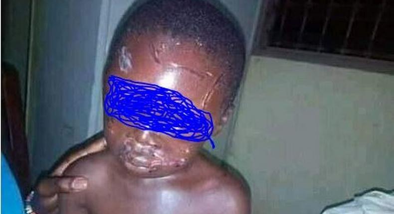 Stepmother brutalises little boy, photos will shake you