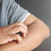 Az orvos videóban hívta fel a figyelmet a májkárosodás 4 jellegzetes bőrtünetére