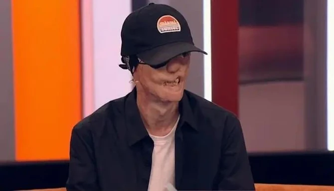 Igor Vinogradov danas