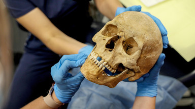 Zbadali czaszki "wampirów z Gliwic". Pierwsze wnioski są zaskakujące [GALERIA]