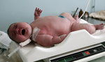 Czy 270-kilogramowa mama urodziła 18-kilogramowe niemowlę?