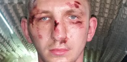 Policjanci mieli brutalnie pobić 24-latka. Sąd bierze ich stronę?