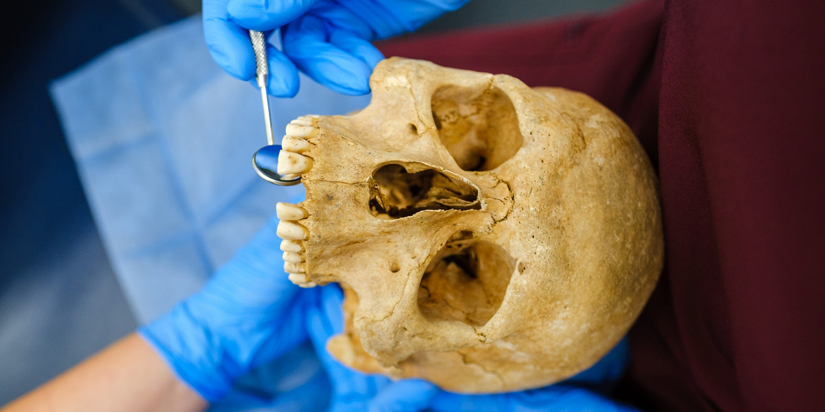 Badanie uzębienia na podstawie czaszki z wykopalisk archeologicznych w Gliwicach. 
