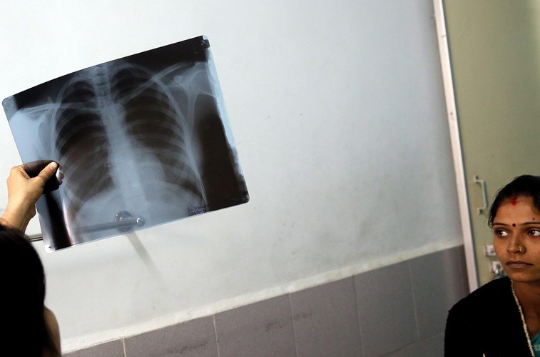 Tradycja i skręcane papierosy beedi powoli zabijają Hindusów