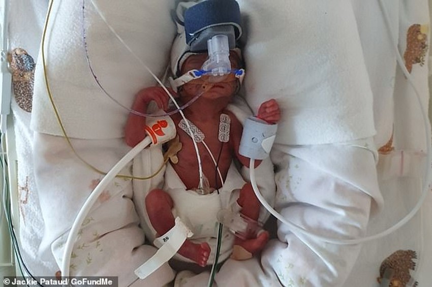 Mala Amalija je na rođenju imala 411 grama