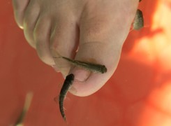 Fish pedicure – modny i ryzykowny?