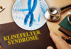 Klinefelterov sindrom je urođeno stanje koje pogađa isključivo muškarce