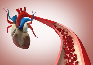 Vrednosti lipoproteina (a) su stabilne, pa jedan uzorak krvi daje doživotni odgovor na pitanje da li osoba nosi ovaj genetski rizik