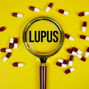 Lupusz – tünetek, diagnózis, kezelés: amit minden érintettnek tudnia kell