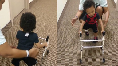 Maluch po amputacji uczy się chodzić. Zobaczcie inspirujące wideo