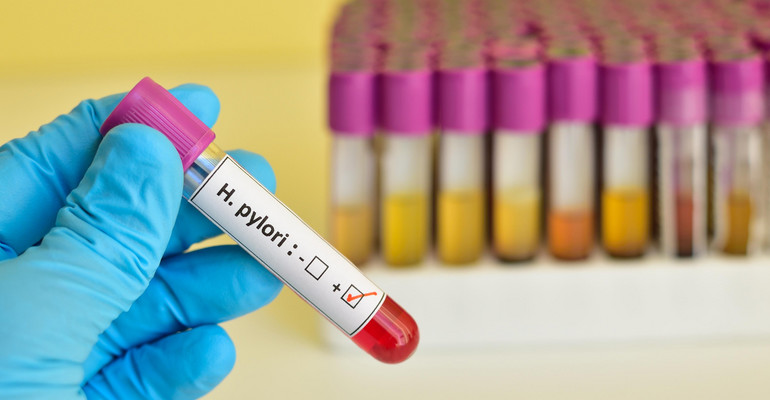 Helicobacter pylori - objawy, diagnostyka (testy), leczenie