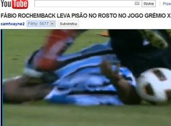 Rywal "przespacerował" się po jego twarzy. Zobacz wideo