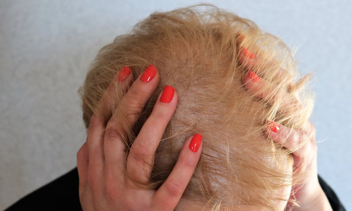 To eliksir na porost włosów. Wysyp "baby hair" choćby na zakolach